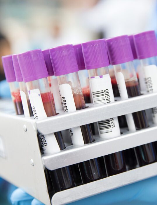 Labelled vials of blood