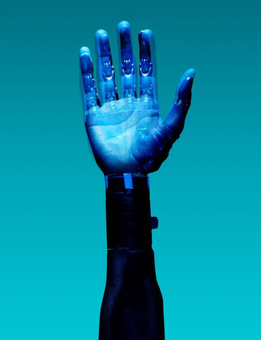 Hand with prosthetic fingers